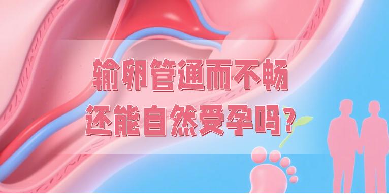 输卵管通而不畅，还能自然受孕吗？